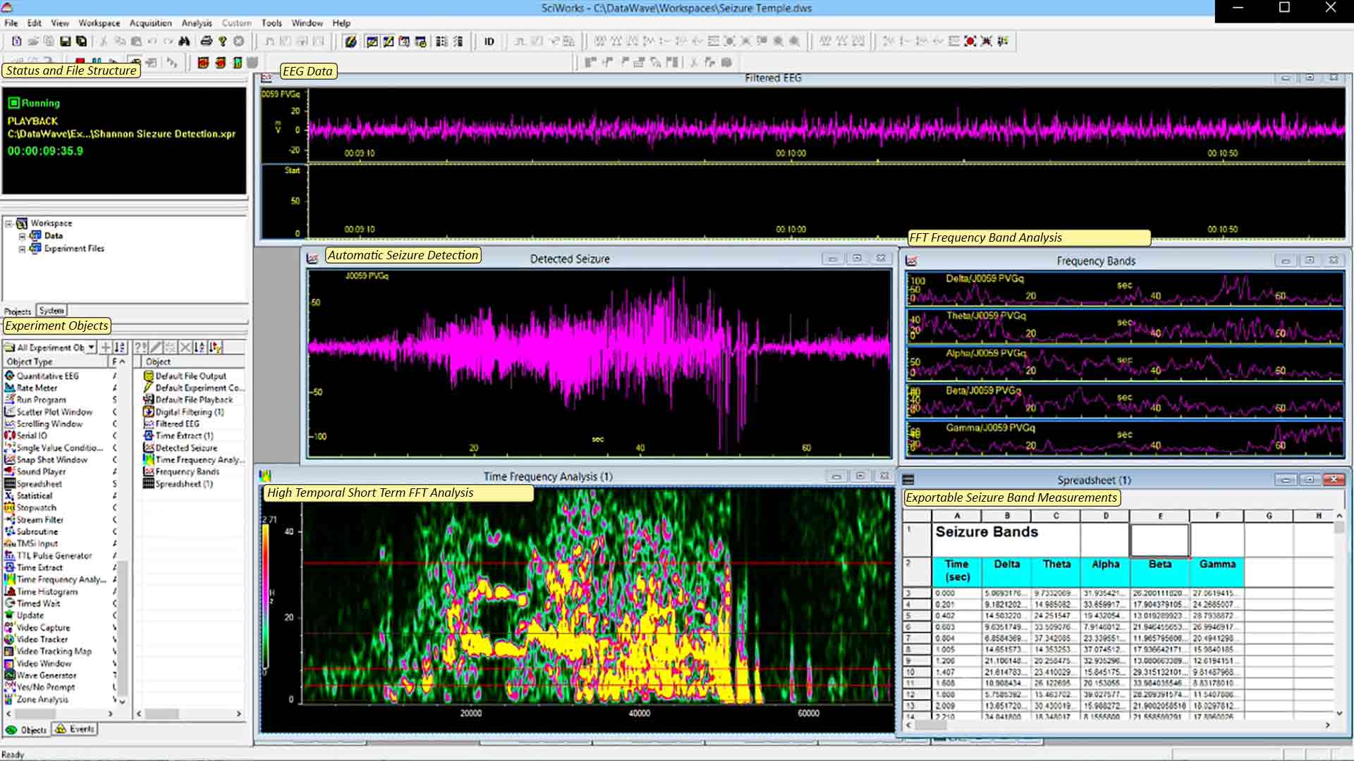 Seizure Activity Recording in SciWorks