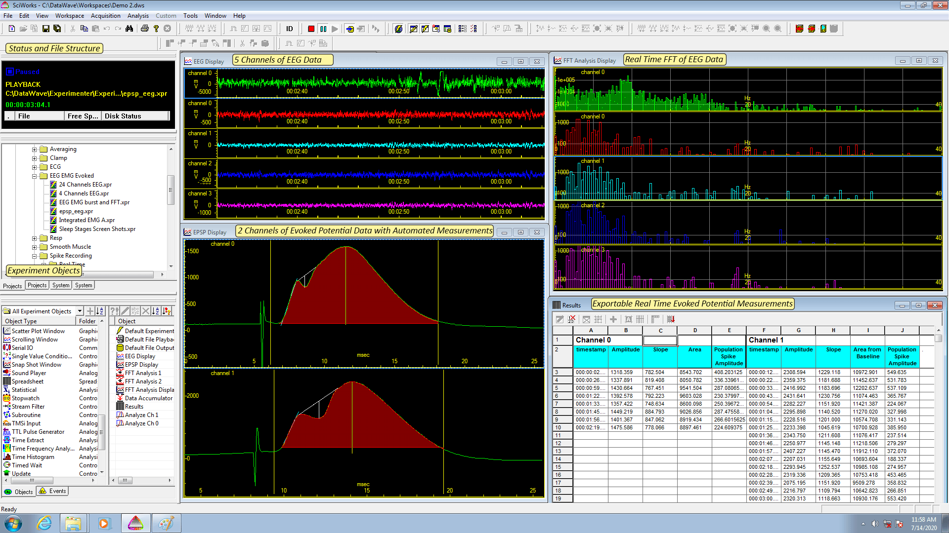 EEG Recording and Analysis in SciWork