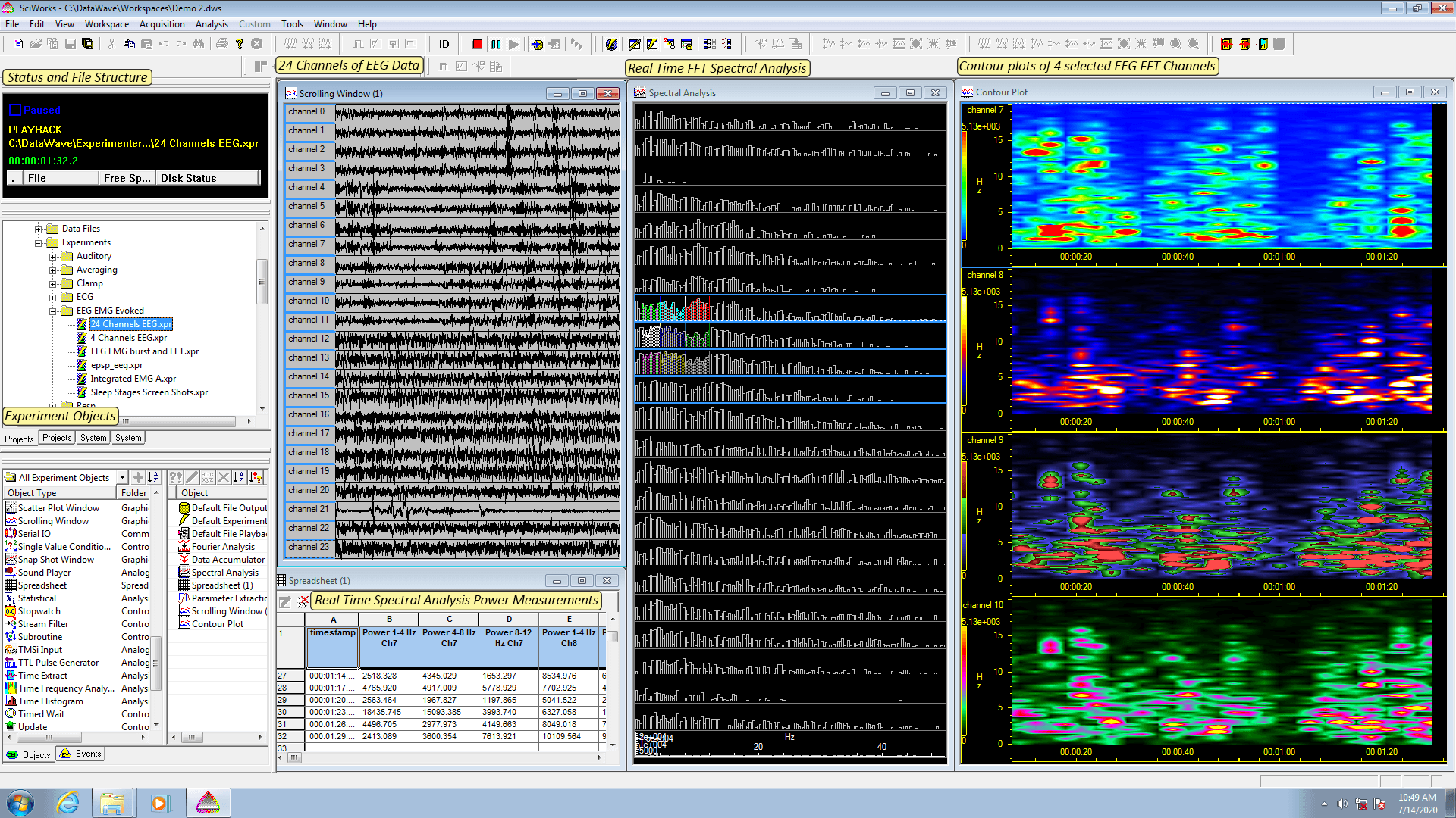 EEG Spectral Analysis in SciWorks Discovery